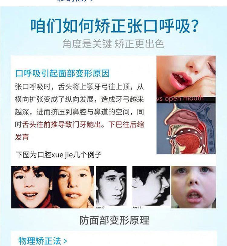 Cross-border black breathing correction anti-snoring device anti-snoring belt men's and women's breathable chubto belt for adults and children