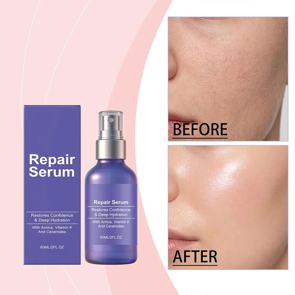 Arnica Vitamin K Skin Repair Serum - 60ml Deep Moisturizing Face Serum