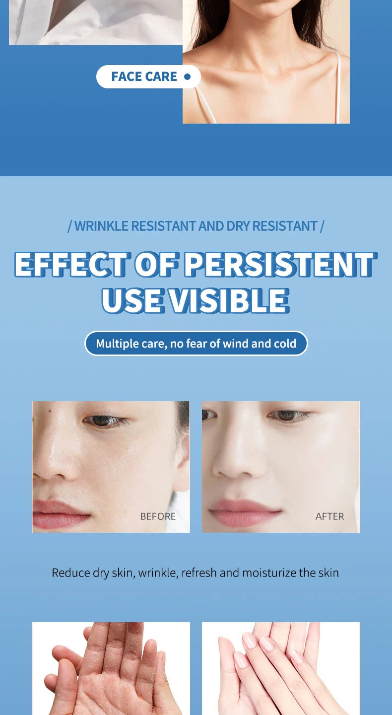 Ocheal Body Skin Foot Care Cream Repair Heel Hand Leg Anti-drying Anti-wrinkle Moisturizing Cracked Exfoliating Soft Care Cream