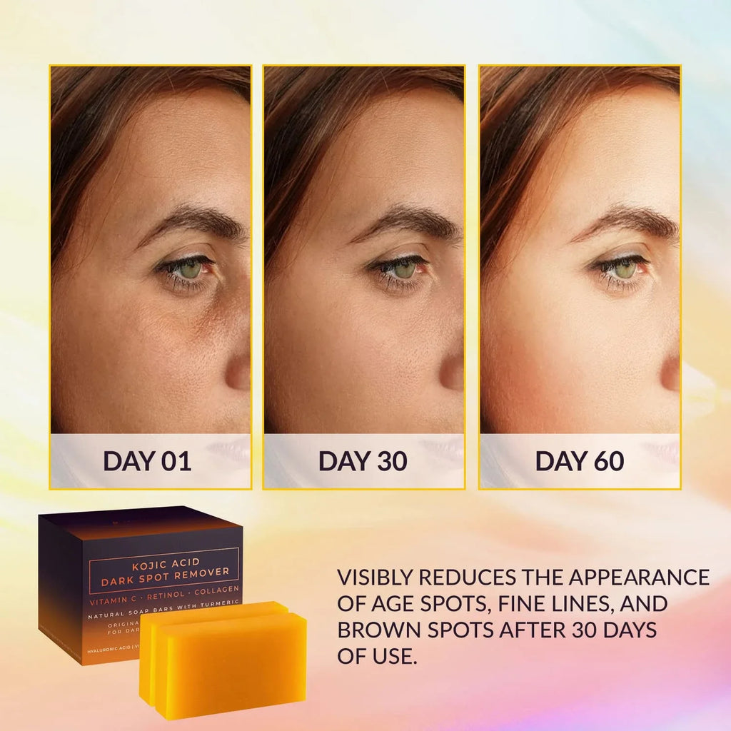 DDBSHIY Kojic Acid Facial Soap - Dark Spot Remover & Cleansing
