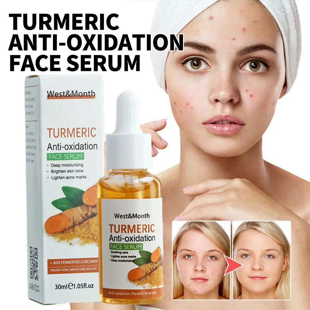 Turmeric Face Whitening Dark Spot Corrector Anti-oxidation Serum Turmeric Dark Spot Corrector Serum Facial Brighten Turmeric Oil