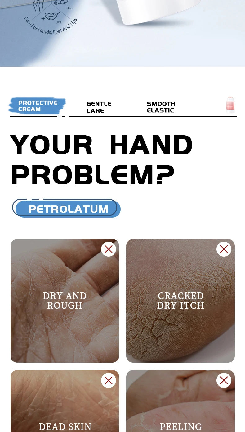 Ocheal Moisturizing Cream Anti-Drying Crack Foot Cream for Hand And Feet Skin Repair Dead Skin Removal Moisturizing Skin Care