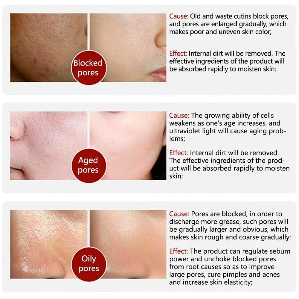 Skin Texture | Pore Refining Resurfacing, Brightening Facial Serum With Retinol And Niacinamide Non-Comedogenic