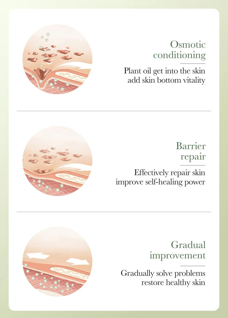 SADOER Avocado Skincare 6-Piece Set - Cleansing, Moisturizing, Care