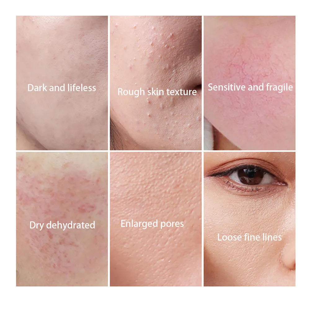 OSUFI Snow Lotus Glacier Firming Facial Contours Beauty Essence Moisturizing penetration Face serum skincare korean Cosmetics