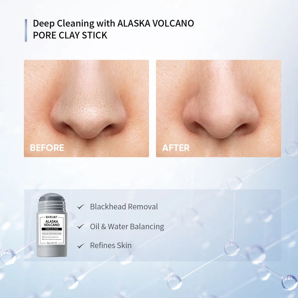 Remove Blackhead Acne Mugwort Solid Mask Cleans Pores Stick Facial Blemish Black Dots Shrink Pores Korean Skin Care Products