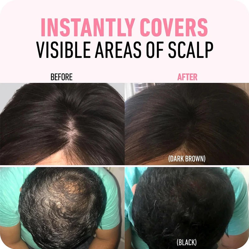 Hairline Shadow Powder,Instantly Conceal Hairline And Hair Root, Waterproof Hairline Powder Filler,Hair Root Cover,Scalp Powder