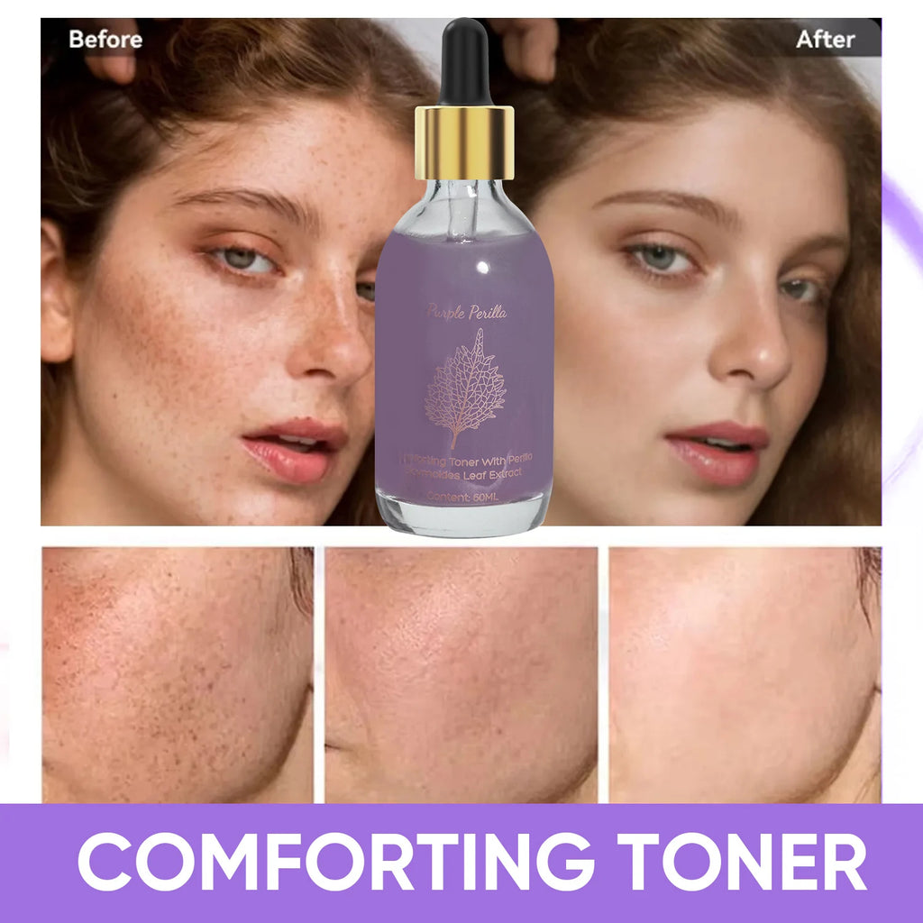 Amococo 2pcs Purple Perilla Calming Toner 60ml Each Soothing Essence for Sensitive Skin Helps Reduce Fine Lines Even Skin Tone K-Beauty
