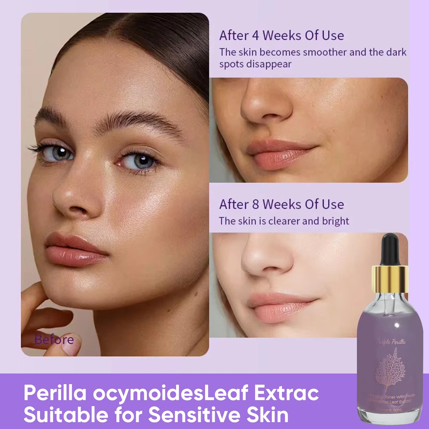 Amococo 2pcs Purple Perilla Calming Toner 60ml Each Soothing Essence for Sensitive Skin Helps Reduce Fine Lines Even Skin Tone K-Beauty