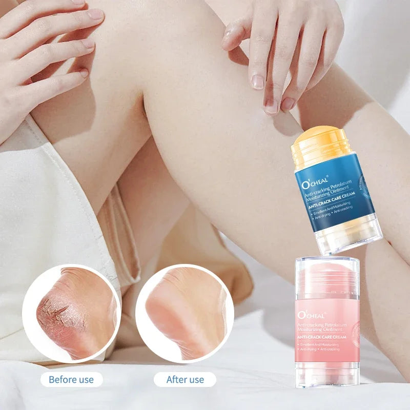 Ocheal Moisturizing Cream Anti-Drying Crack Foot Cream for Hand And Feet Skin Repair Dead Skin Removal Moisturizing Skin Care