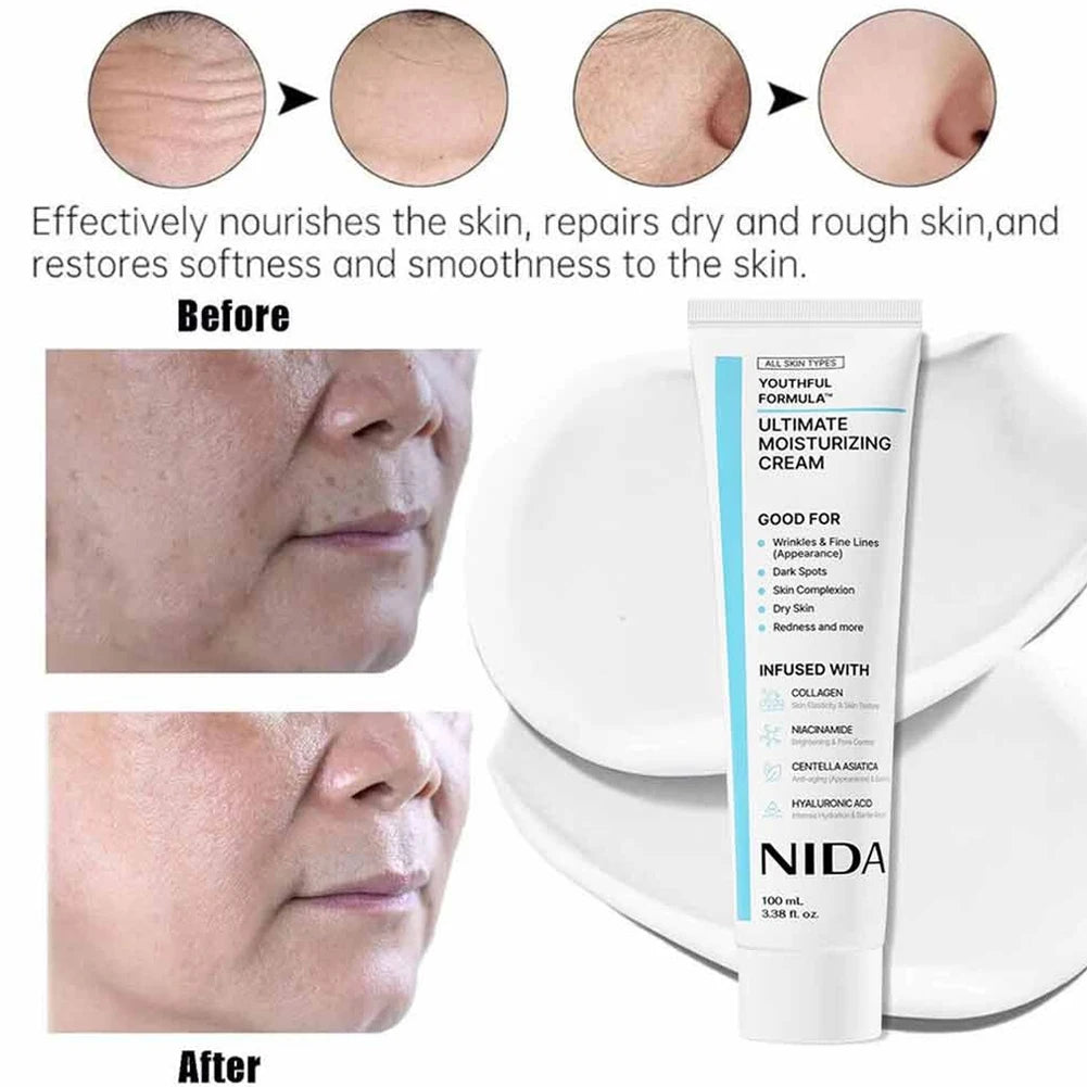 Korea Nida Moisturizing Ultimate Cream Daily Facial Skin Care Tighten Shrink Pores Improve Fine Lines Rejuvenating Facial Skin