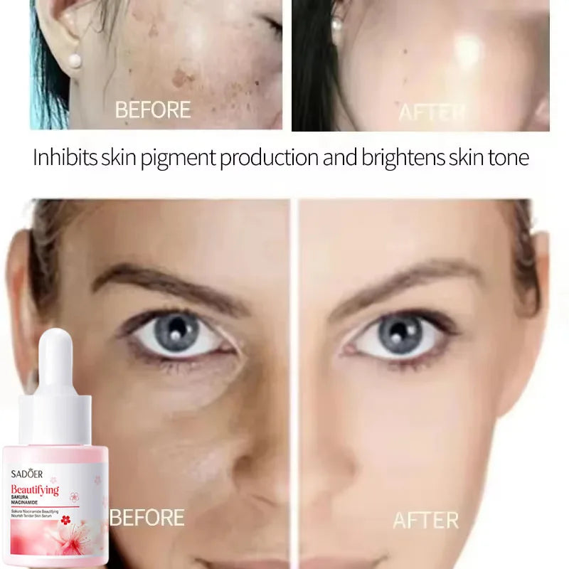 Niacinamide Dark Spot Remove Serum Face Freckle Melanin Correcting Moisturizing Brightening Anti Pigmentation Repair Skin Care