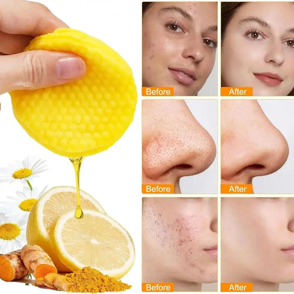 1/2/3/4/5/10BOX Turmeric Kojic Acid Cleansing Pads Exfoliating Pads Facial Sponges For  Exfoliating Daily Cleansing Skin Care