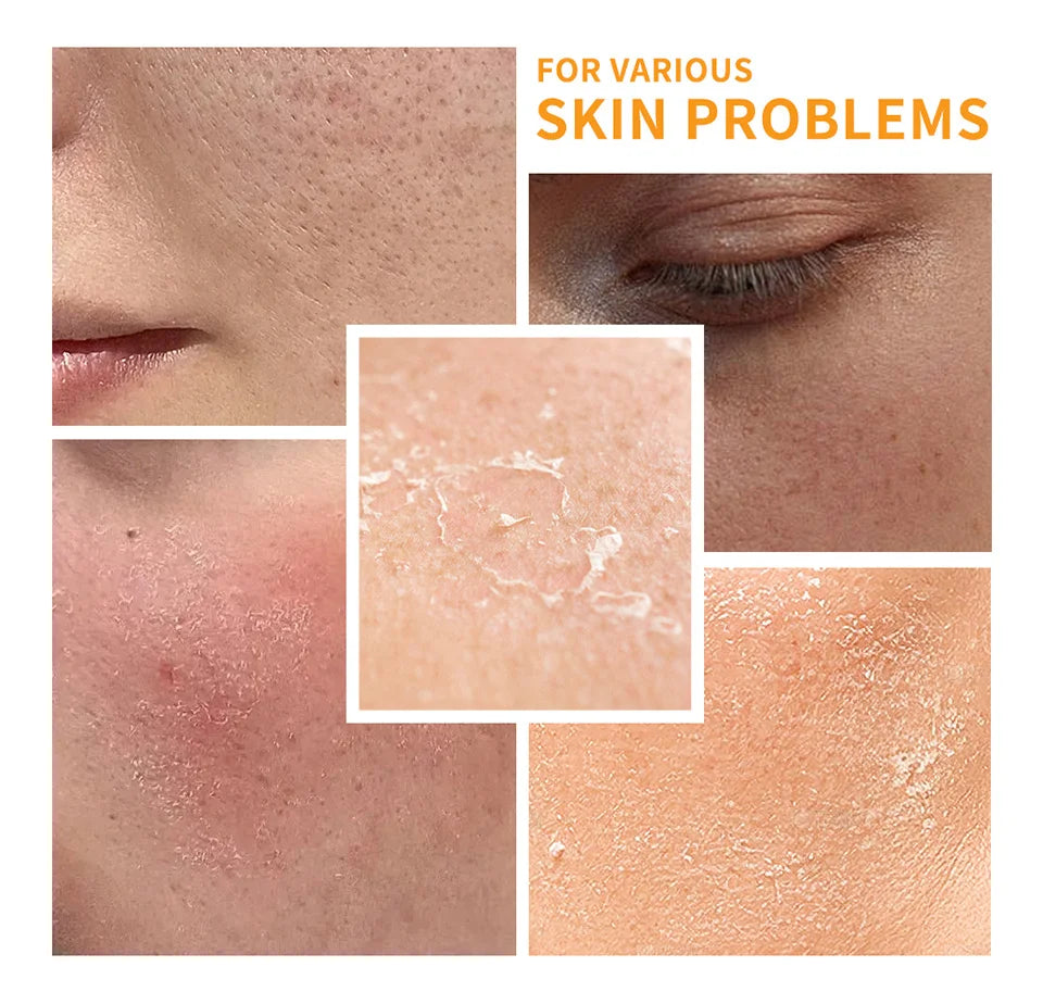 Vitamin C Enriched Skin Care Set - Combat Pigmentation & Fine Lines with Complete Routine Smooth Wrinkles, and Nurture Your Skin