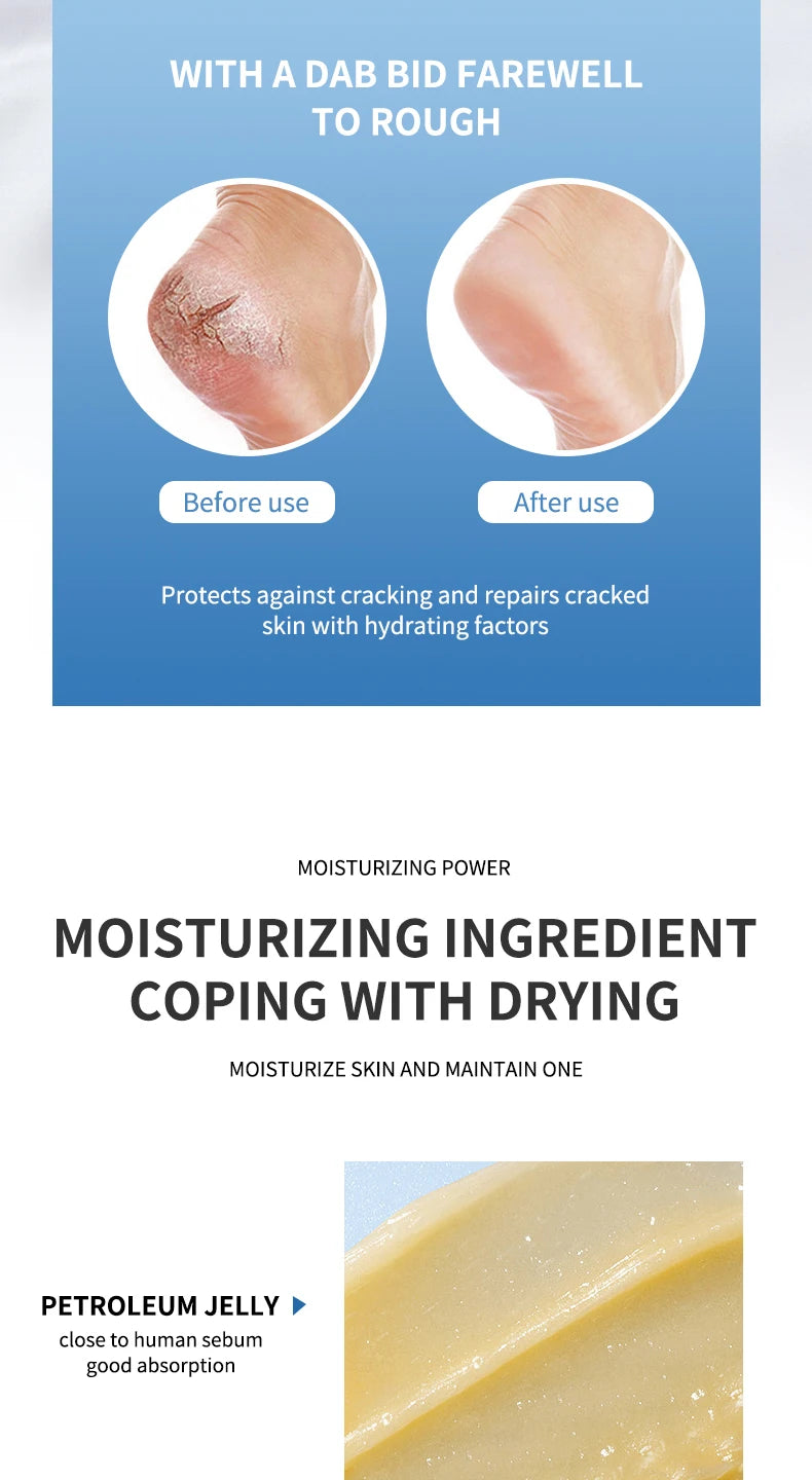 Ocheal Body Skin Foot Care Cream Repair Heel Hand Leg Anti-drying Anti-wrinkle Moisturizing Cracked Exfoliating Soft Care Cream