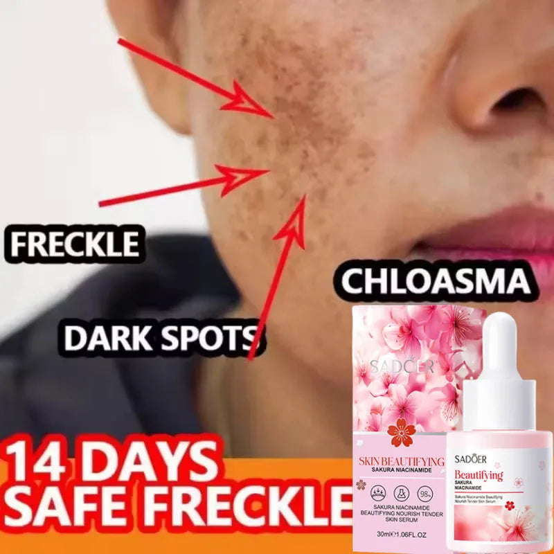 Niacinamide Dark Spot Remove Serum Face Freckle Melanin Correcting Moisturizing Brightening Anti Pigmentation Repair Skin Care