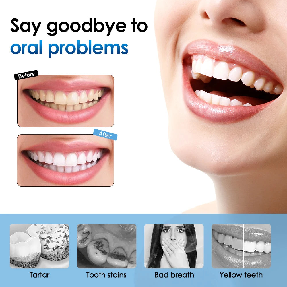 Electric Toothbrush Sonic Dental Teeth Whitening Kit Tooth Whitener Calculus Tartar Remover Tools Cleaner Stain Oral Care