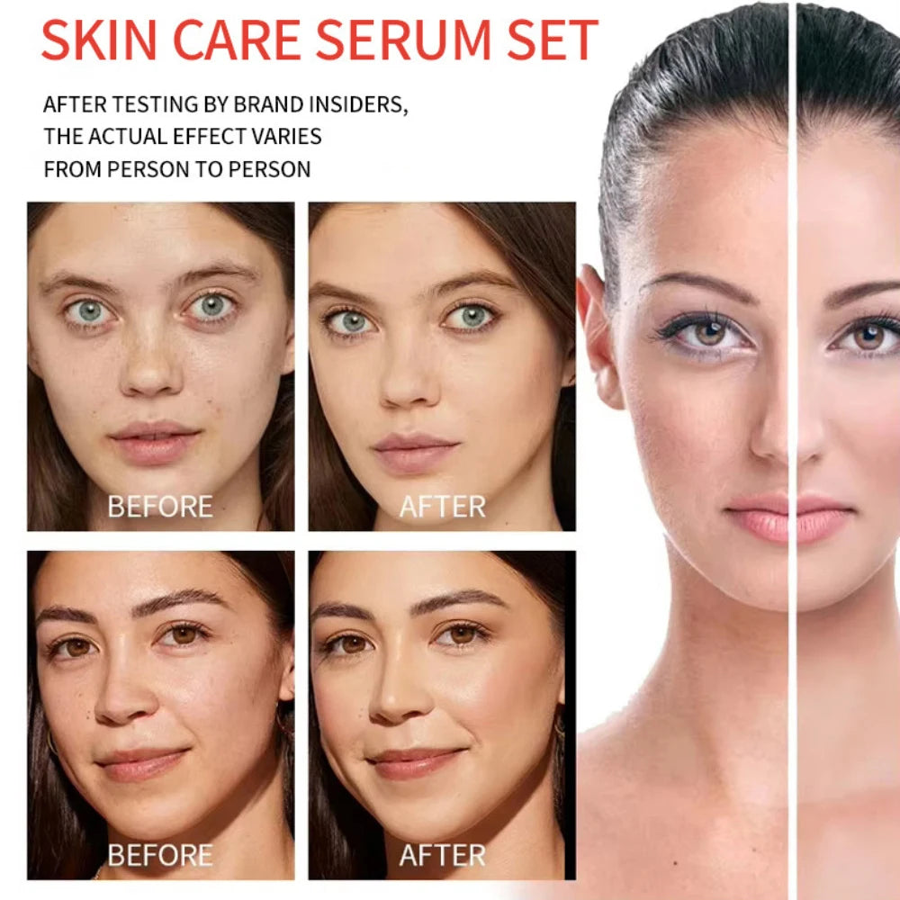 Vitamin C AHA Essence Original liquid Kojic Acid Face Serum Arbutin Brightn Moisturizing Turmeric Repair Lifting Skin Care 350ml