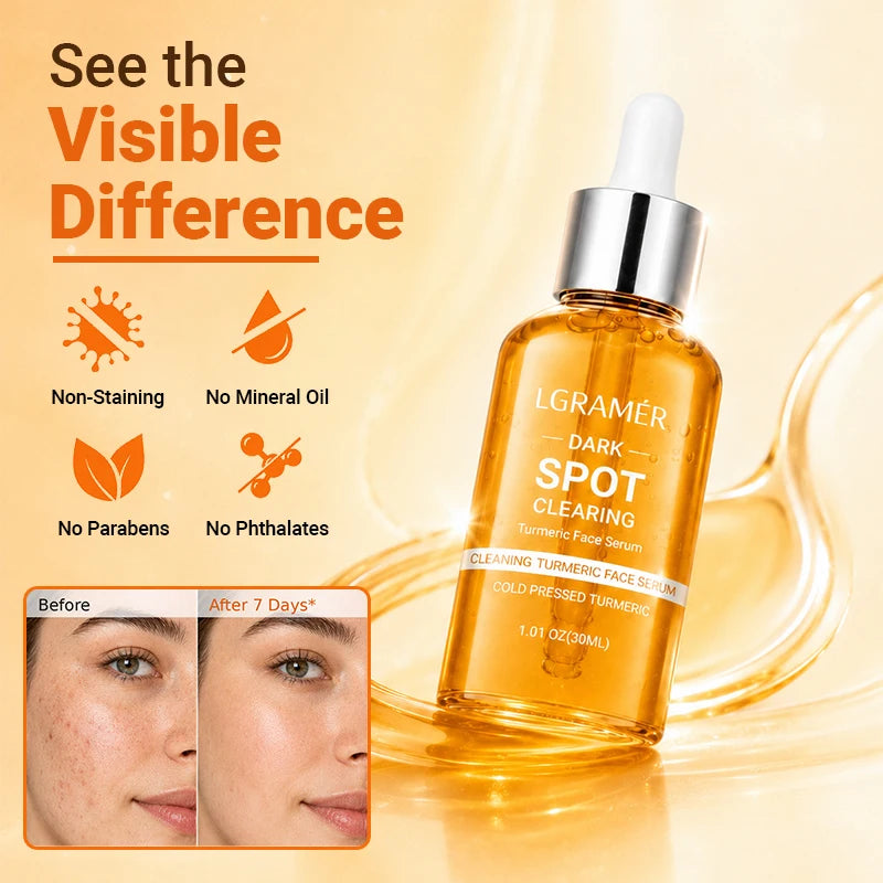 30ml/50ml Turmeric Face Serum 10% Glycolic Acid 2% Niacinamide Dark Spot Remover Corrector Brightening Anti-Aging Facial Serum