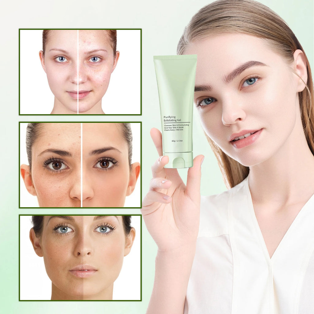Facial Exfoliating Gel - Deep Cleansing & Blackhead Remover