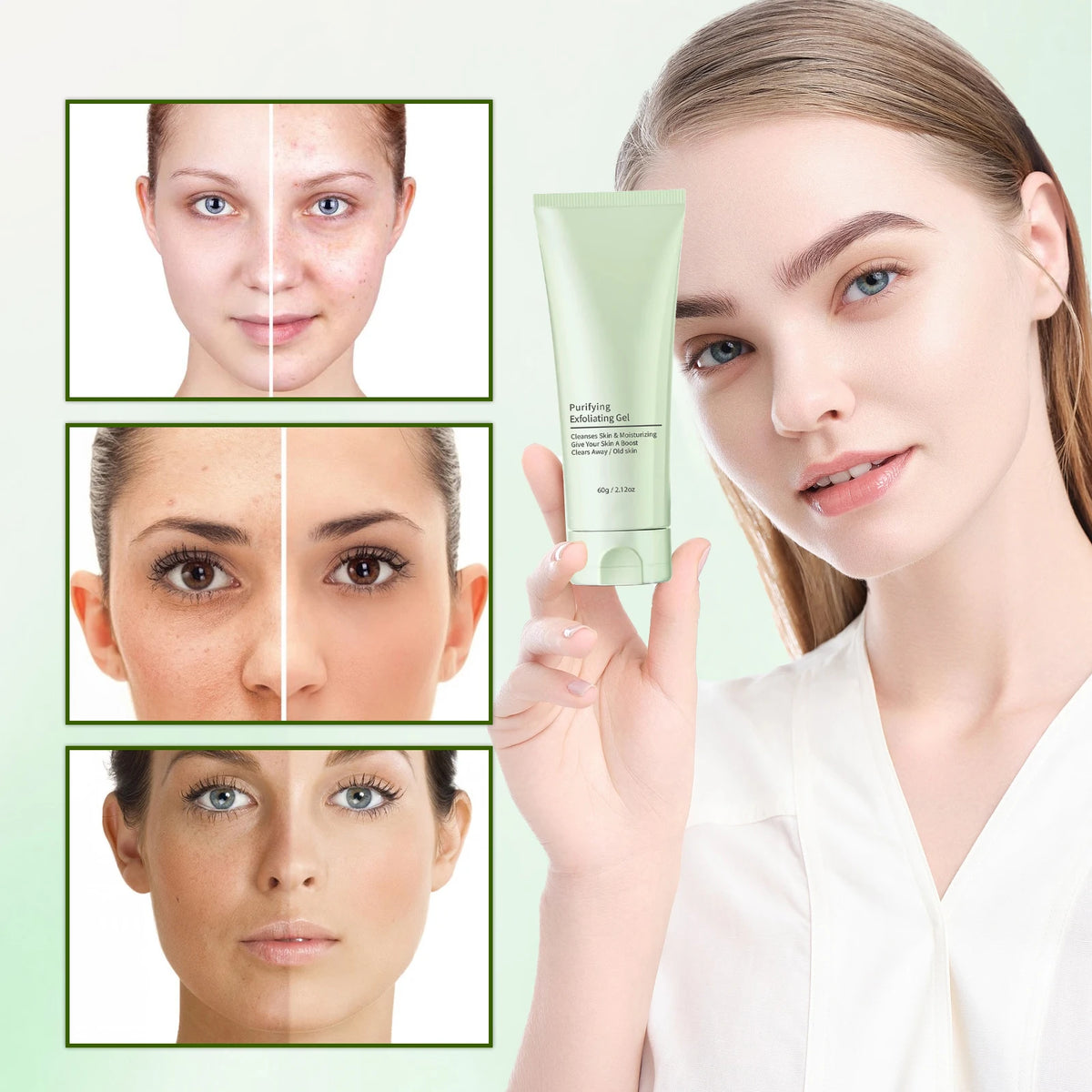 Facial Exfoliating Gel - Deep Cleansing & Blackhead Remover