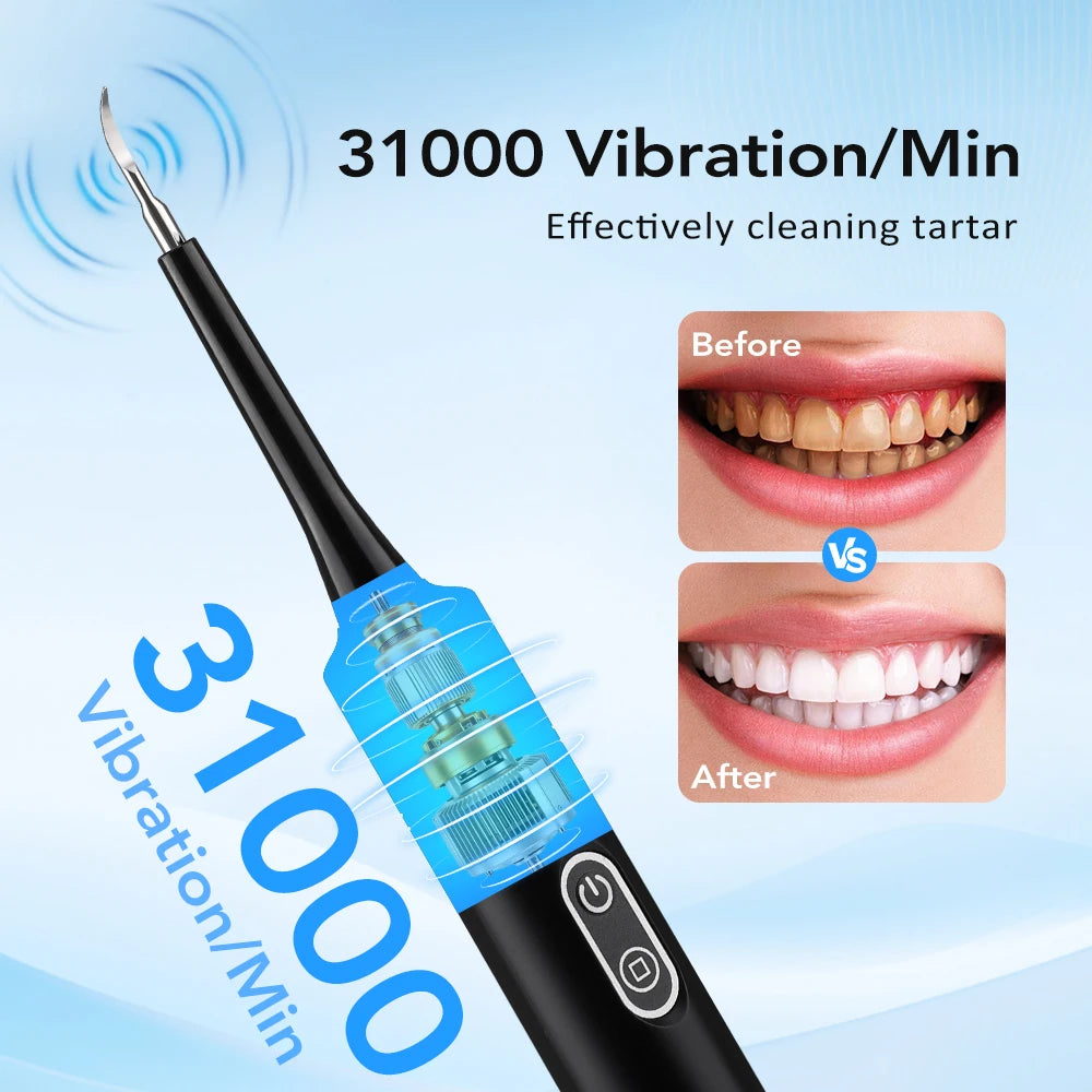 Electric Dental Scaler with Teeth Brush Head Calculus Tartar Remover Vibration Teeth Plaque Cleaner Oral Care Improve Odor