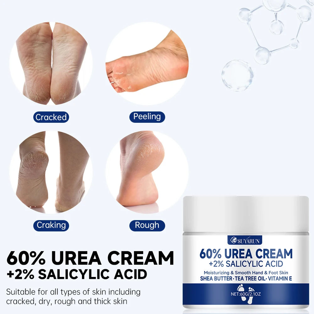 SUYARUN 60% Urea Cream for Cracked Heels and Dry Skin