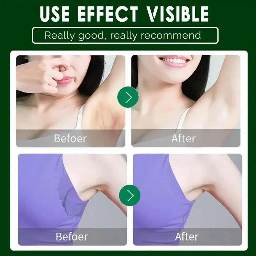 Underarm Deodorant Cream - Herbal Antiperspirant for Body Odor 10g