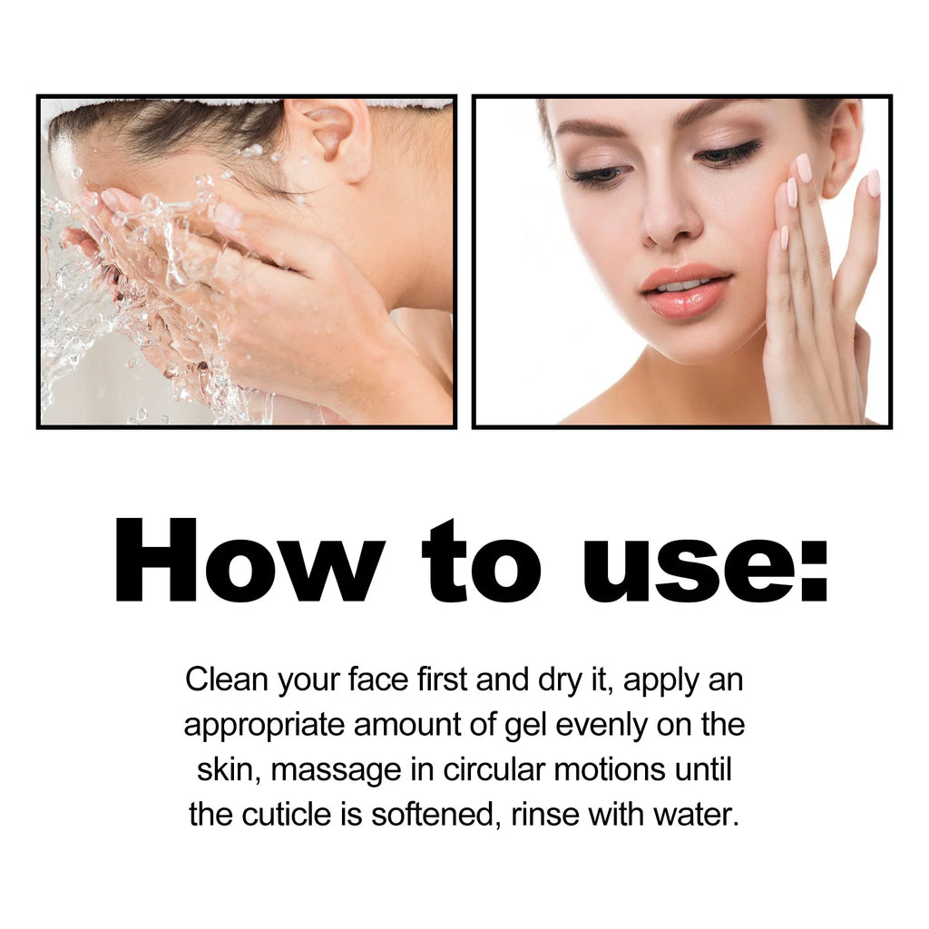 West&Month Exfoliating Peeling Gel - 50g Acne & Blackhead Treatment