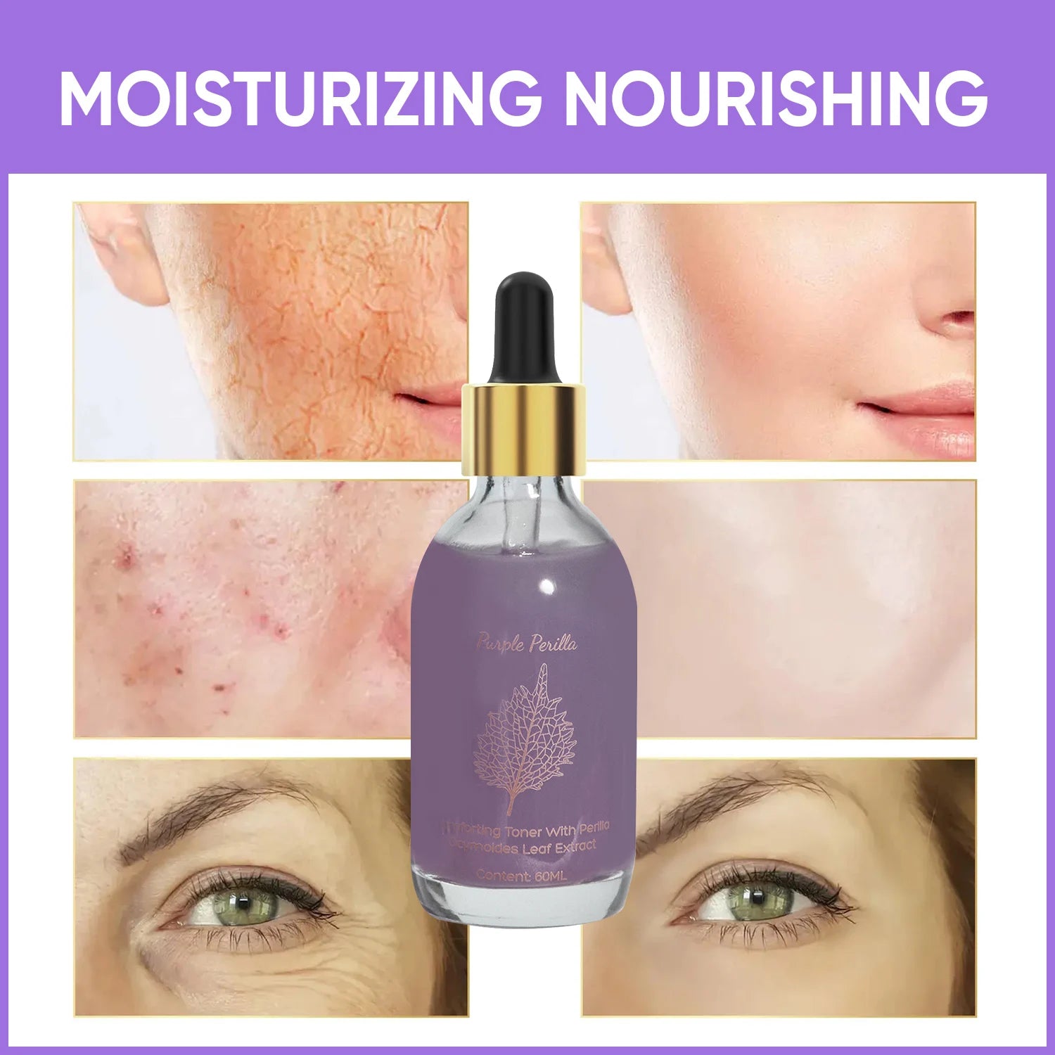 Amococo 2pcs Purple Perilla Calming Toner 60ml Each Soothing Essence for Sensitive Skin Helps Reduce Fine Lines Even Skin Tone K-Beauty