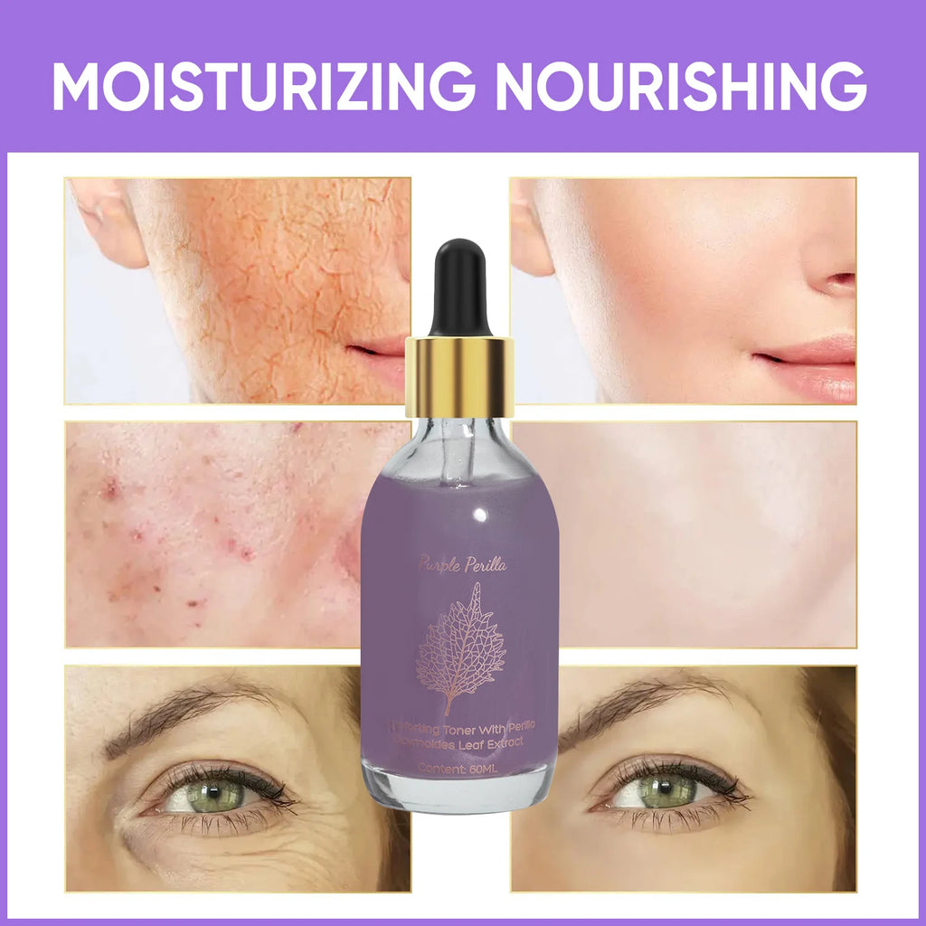 Amococo 2pcs Purple Perilla Calming Toner 60ml Each Soothing Essence for Sensitive Skin Helps Reduce Fine Lines Even Skin Tone K-Beauty