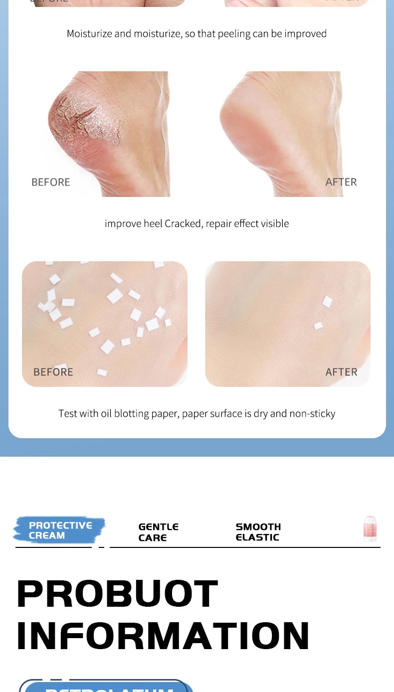 Ocheal Moisturizing Cream Anti-Drying Crack Foot Cream for Hand And Feet Skin Repair Dead Skin Removal Moisturizing Skin Care