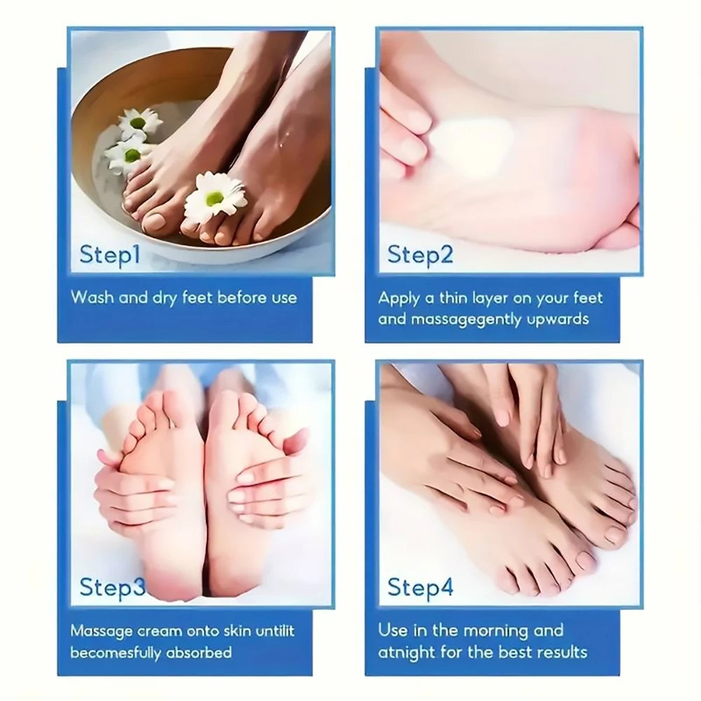 SUYARUN 60% Urea Cream for Cracked Heels and Dry Skin