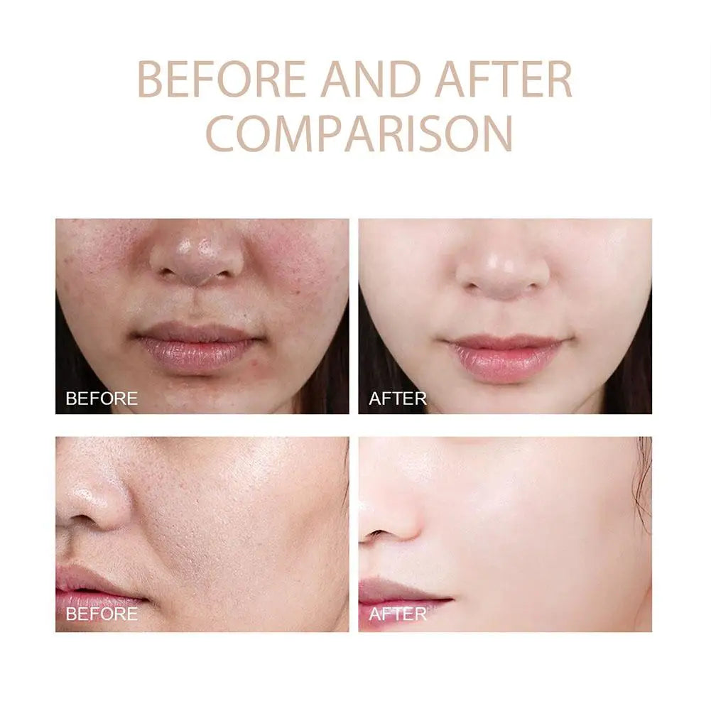 OUHOE Purifying Exfoliating Gel - Pore Refining Face Scrub 50g