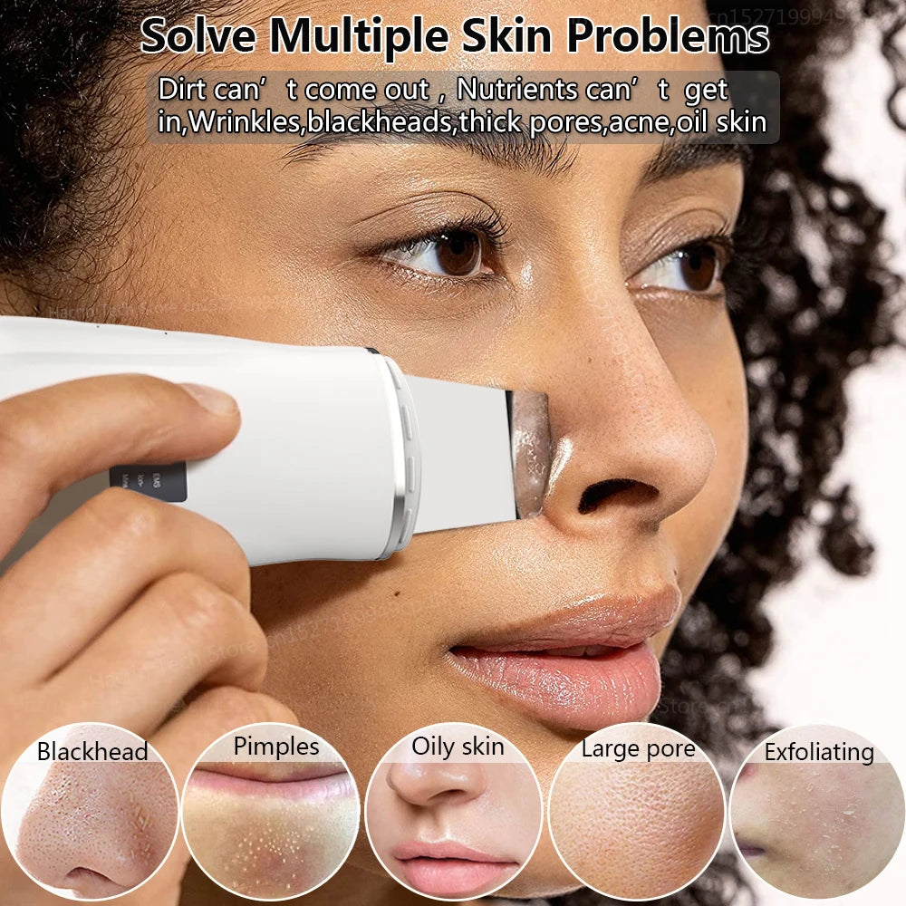 Ultrasonic Skin Scrubber Blackhead Remover Peeling Pore Cleaner Face Cleaning Blackhead Removal Shovel Face Deep Cleaning Device
