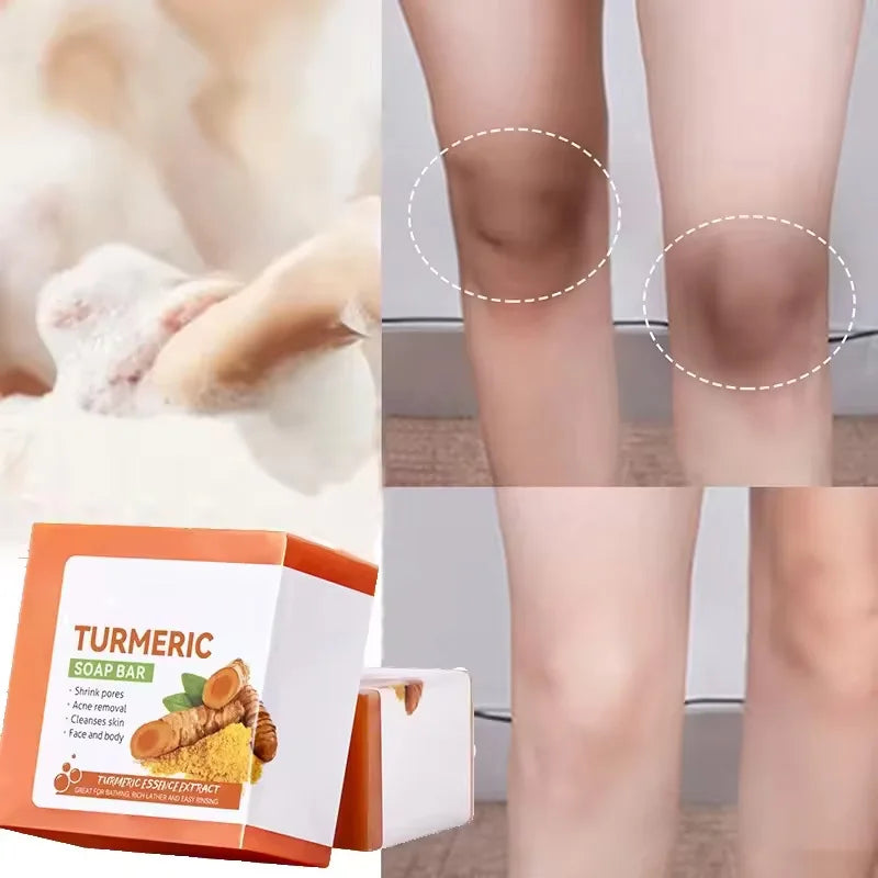 Natural Turmeric Soap Body Cleaning Lightening Dark Underarm Leg Bath Cleansers Brightening Face  Soap Tender Skin Care Beauty