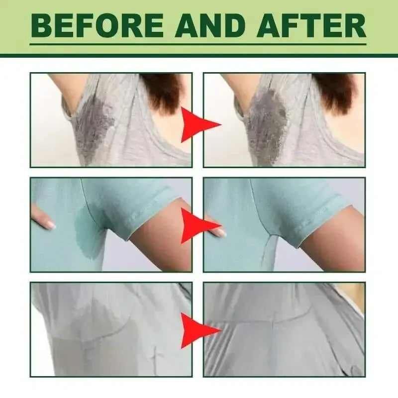 Underarm Deodorant Cream - Herbal Antiperspirant for Body Odor 10g