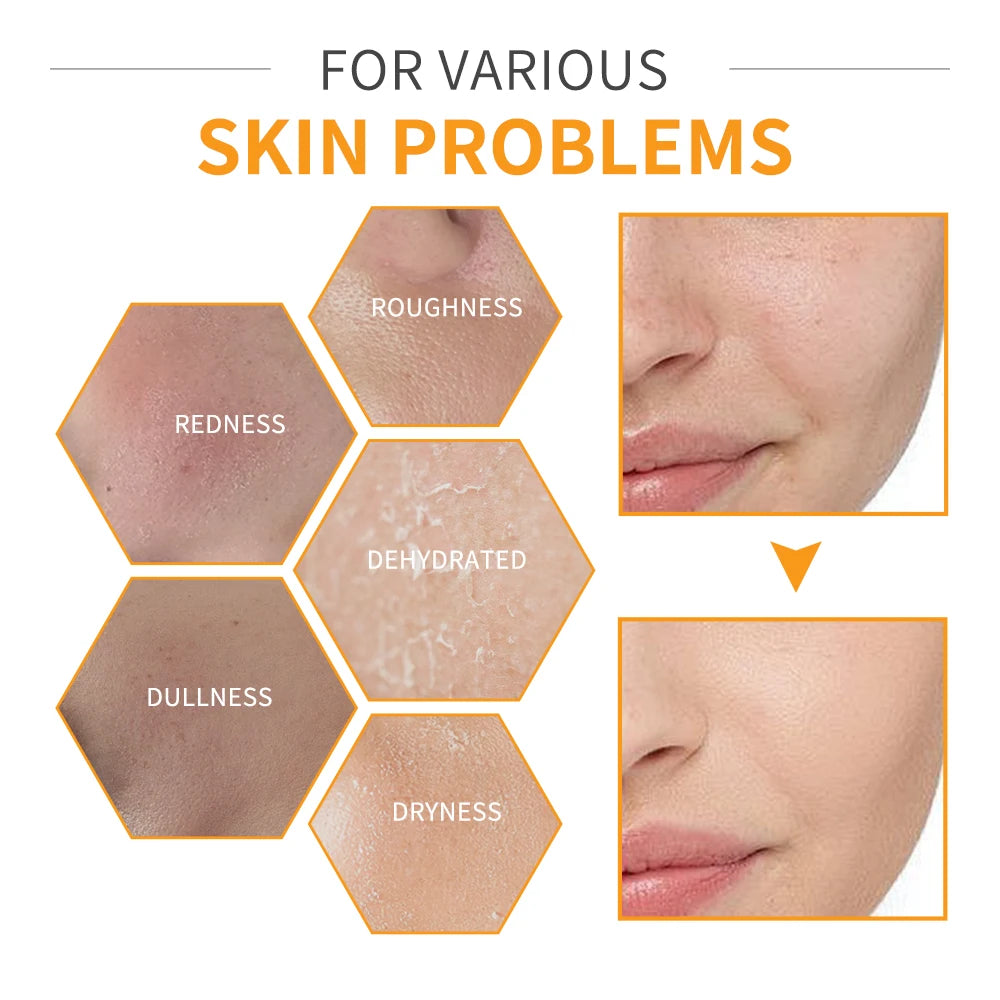 Vitamin C Enriched Skin Care Set - Combat Pigmentation & Fine Lines with Complete Routine Smooth Wrinkles, and Nurture Your Skin