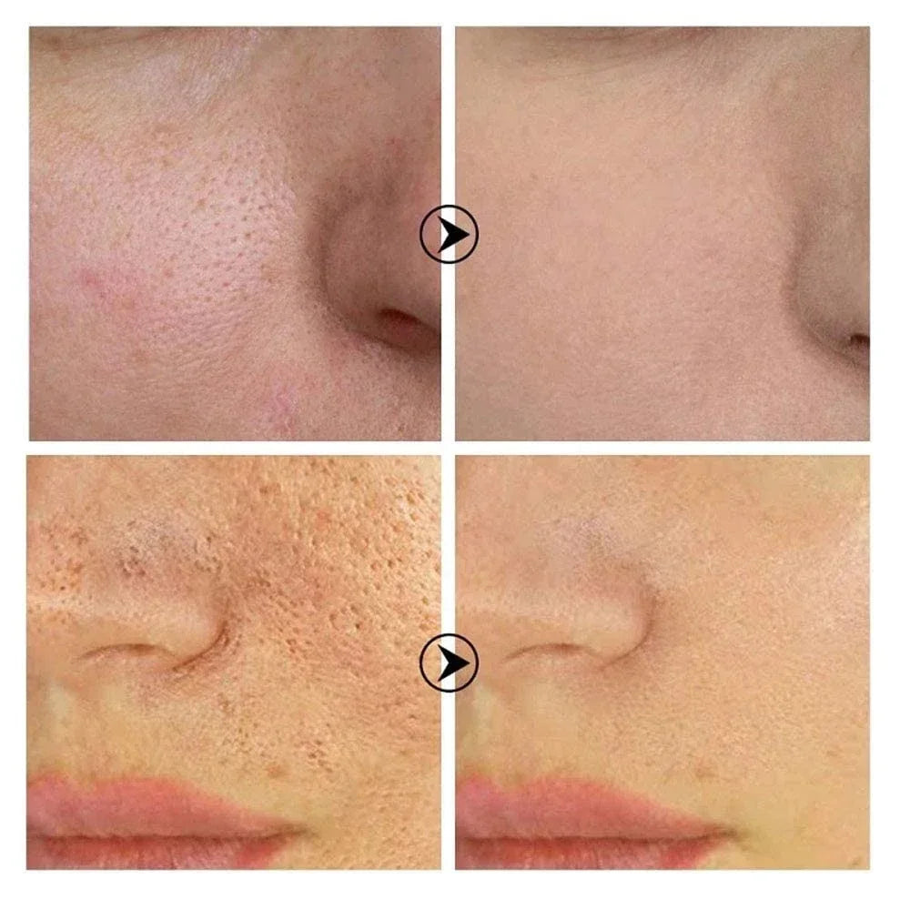 Skin Texture | Pore Refining Resurfacing, Brightening Facial Serum With Retinol And Niacinamide Non-Comedogenic
