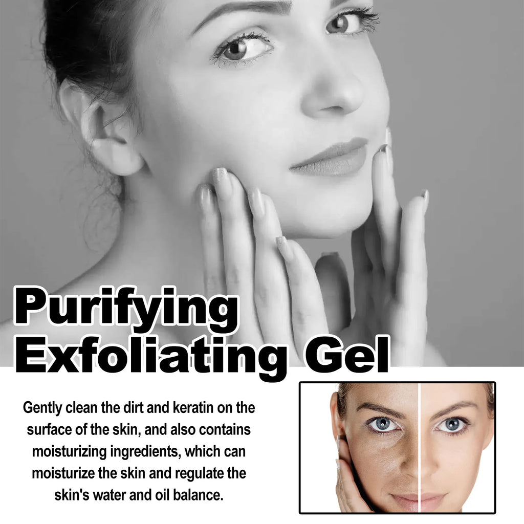 West&Month Exfoliating Peeling Gel - 50g Acne & Blackhead Treatment