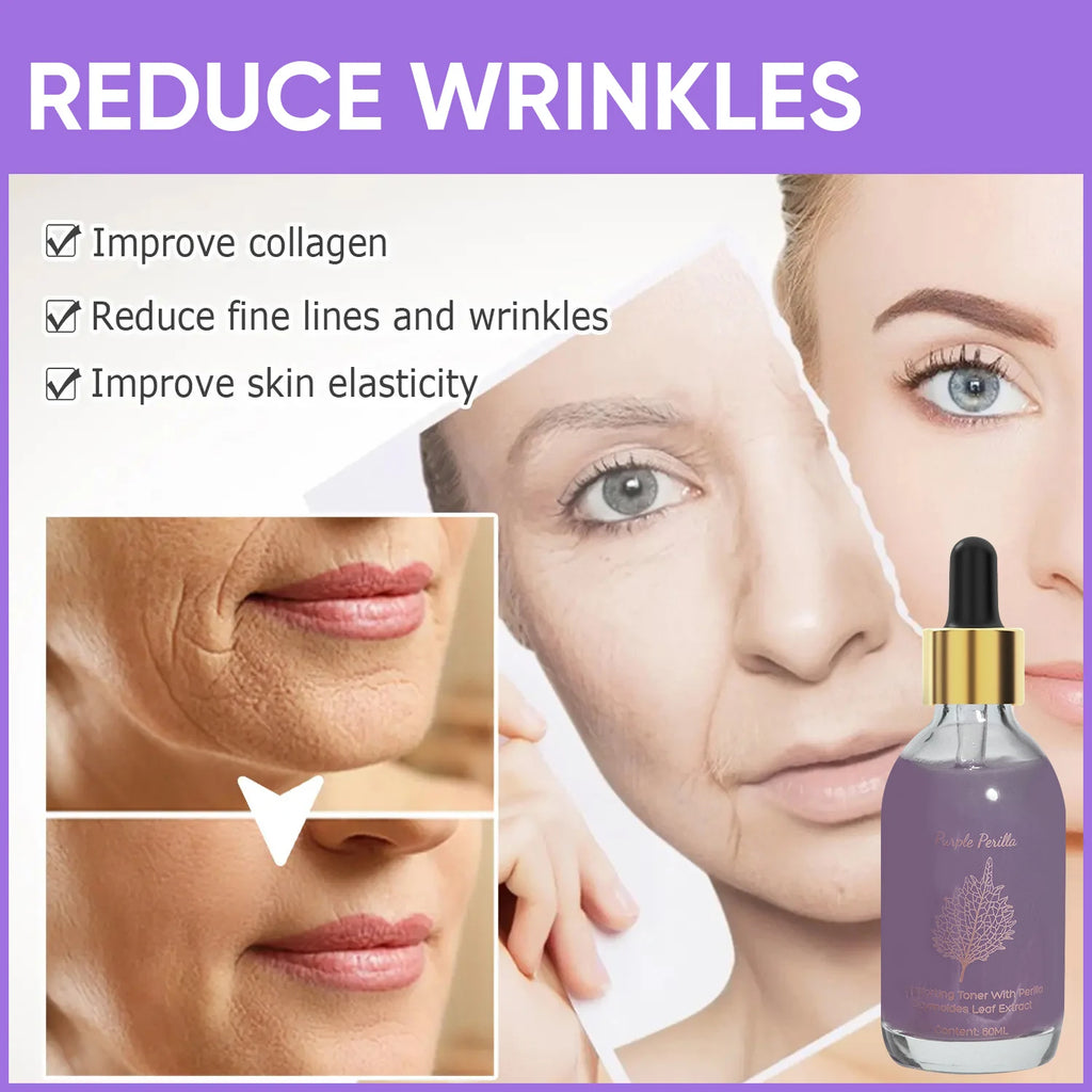 Amococo 2pcs Purple Perilla Calming Toner 60ml Each Soothing Essence for Sensitive Skin Helps Reduce Fine Lines Even Skin Tone K-Beauty