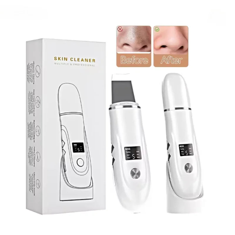Ultrasonic Skin Scrubber Blackhead Remover Peeling Pore Cleaner Face Cleaning Blackhead Removal Shovel Face Deep Cleaning Device