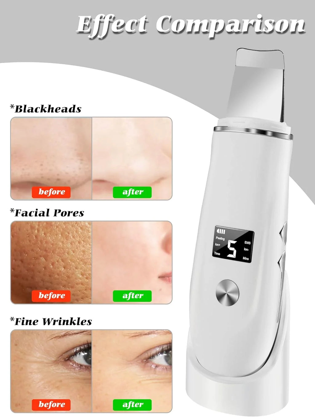 Ultrasonic Skin Scrubber Blackhead Remover Peeling Pore Cleaner Face Cleaning Blackhead Removal Shovel Face Deep Cleaning Device