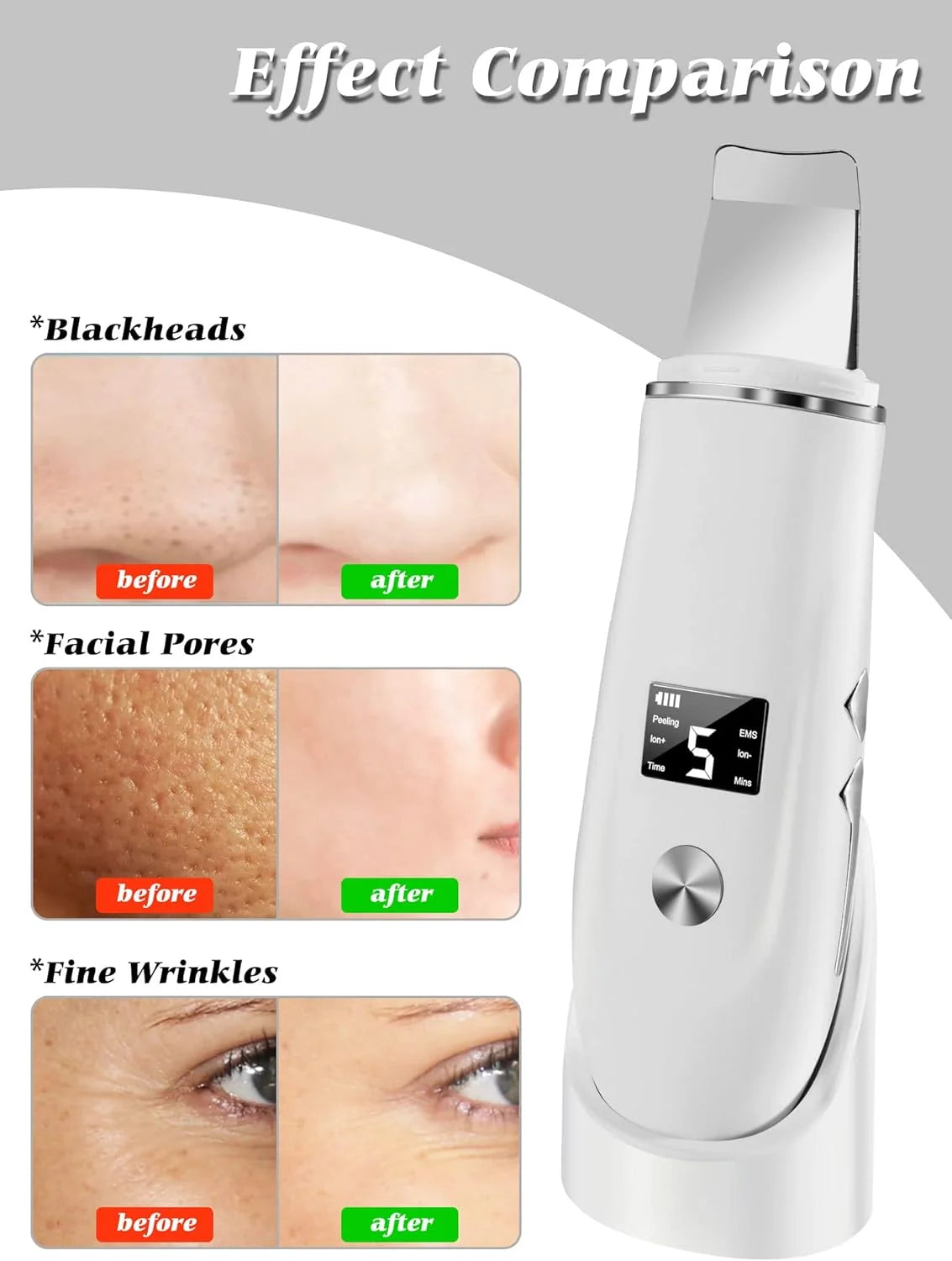 Ultrasonic Skin Scrubber Blackhead Remover Peeling Pore Cleaner Face Cleaning Blackhead Removal Shovel Face Deep Cleaning Device