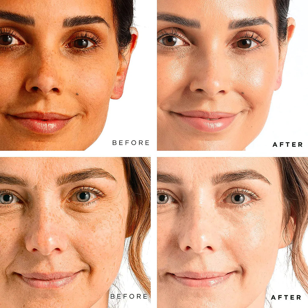 AILKE Whitening Dark Spots Remove Facial Skin Care Cream With Collagen, Reduce Freckles, Wrinkles, Women Premium Face Product