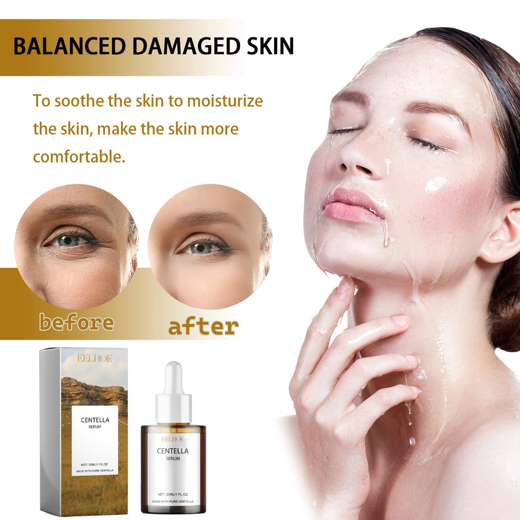 Eelhoe Centella 3-Step Skincare Set - Cleansing Oil, Foam & Serum