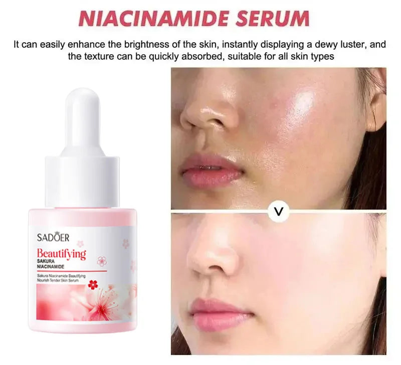 Niacinamide Dark Spot Remove Serum Face Freckle Melanin Correcting Moisturizing Brightening Anti Pigmentation Repair Skin Care