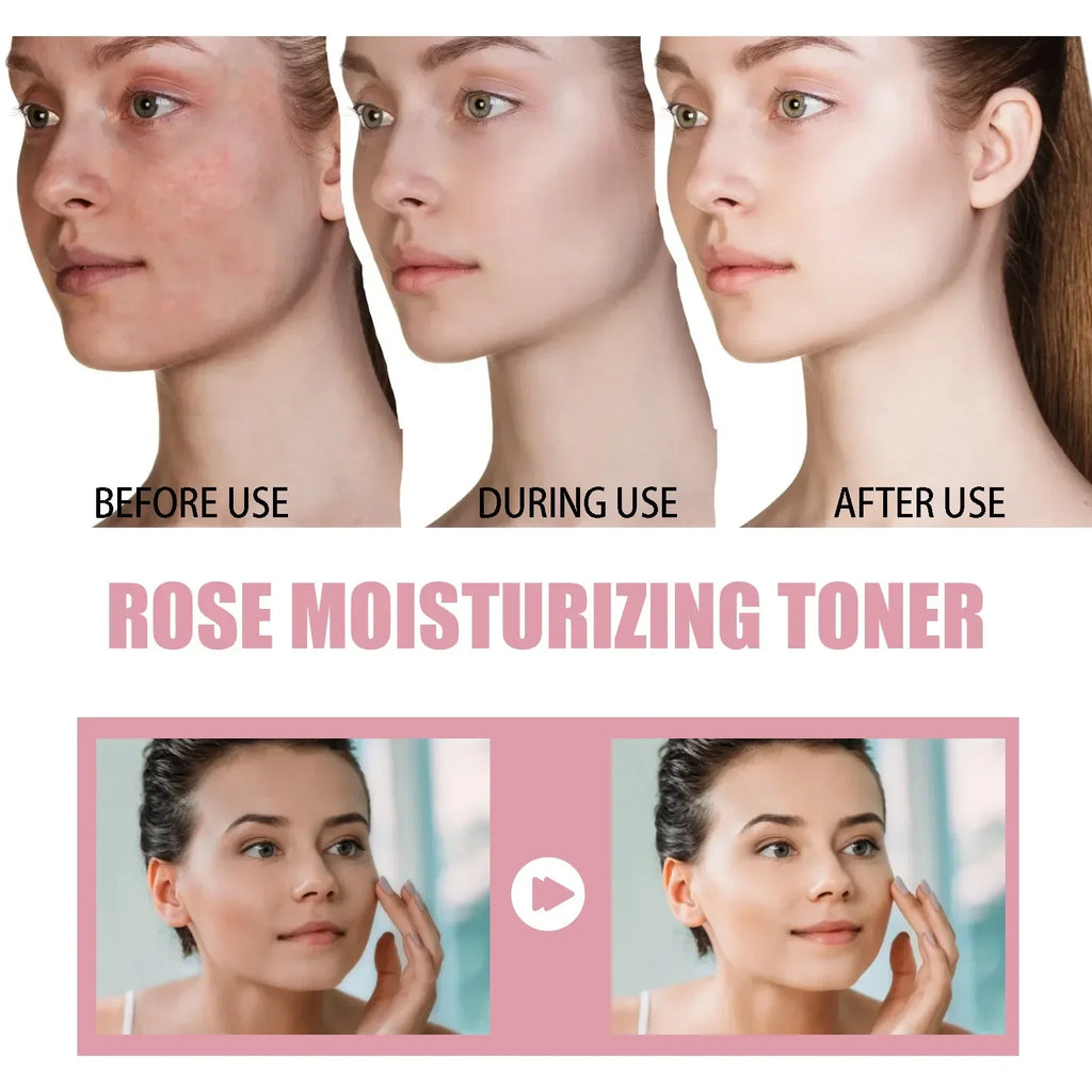 Rose Water Facial Spray Moisturizing Toner for Dry Skin Pore Minimization Bridal Skin Care Pre-Wedding Prep Facial Mist