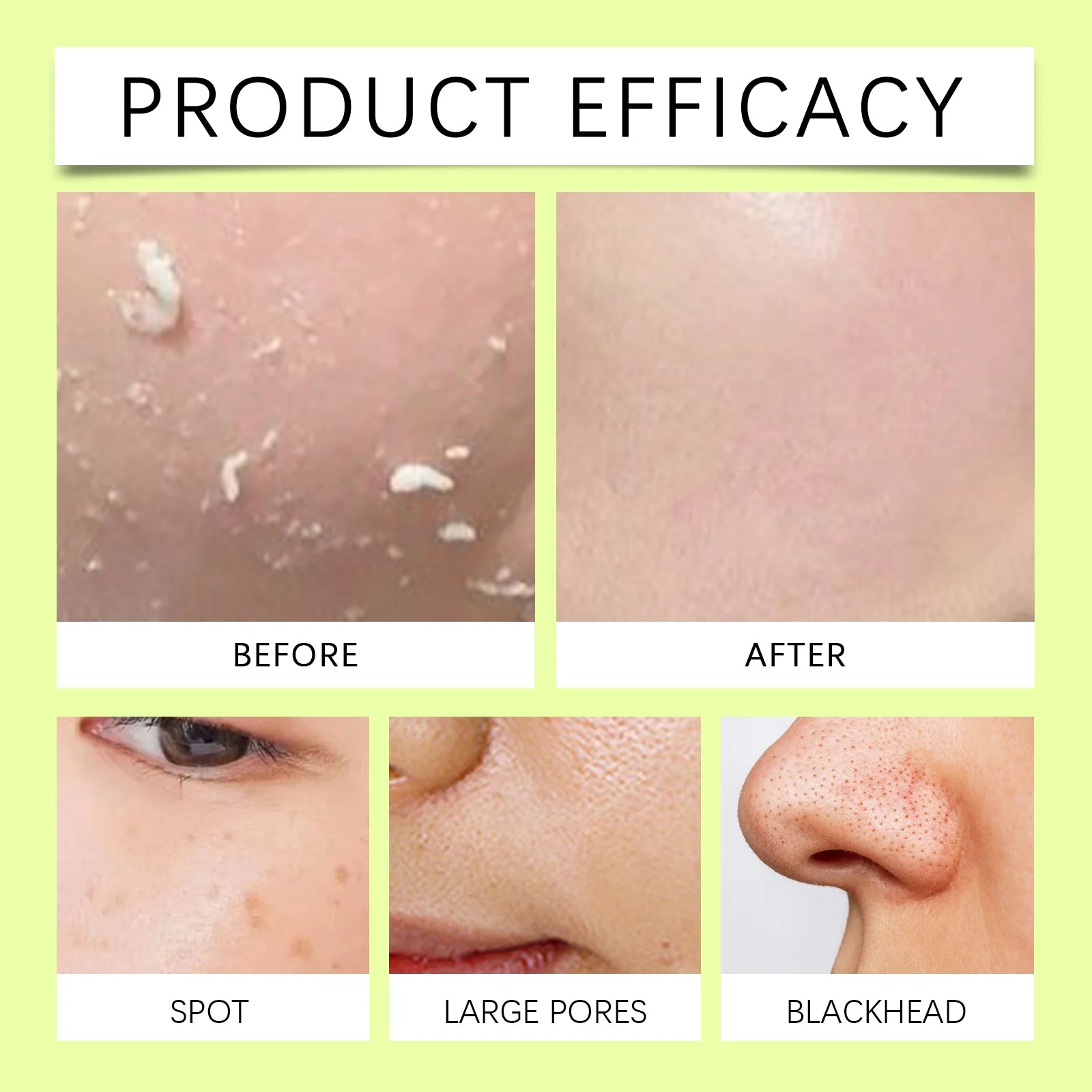 Facial Exfoliating Gel Mild Moisturizing Non-Drying Facial Skincare Treatment Hydrating Pore Refining Smooth Skin Exfoliating