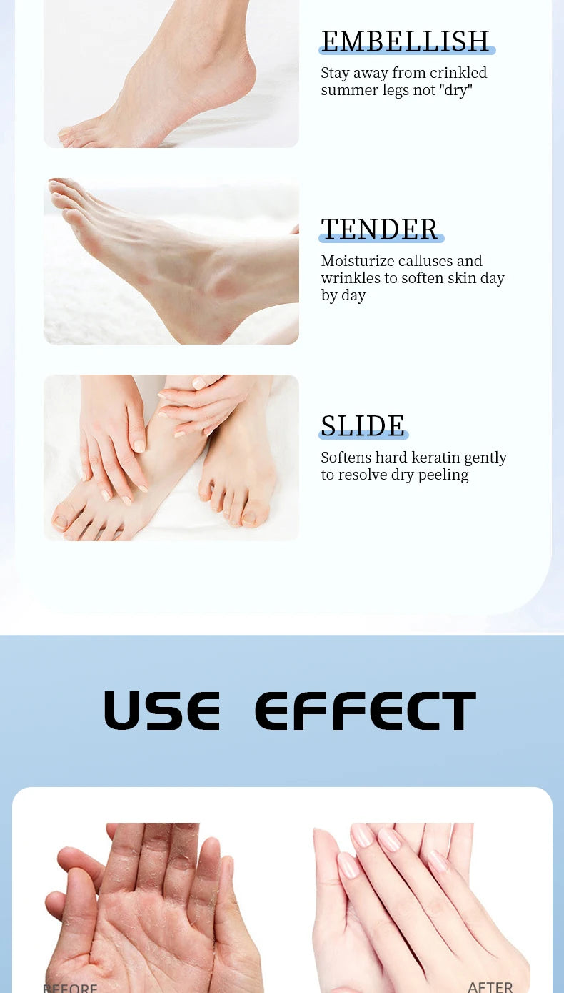 Ocheal Moisturizing Cream Anti-Drying Crack Foot Cream for Hand And Feet Skin Repair Dead Skin Removal Moisturizing Skin Care